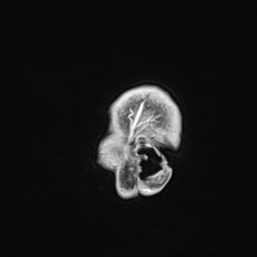 Click on the Serie image to view the images of VILLANUEVA, WILLIAM A.